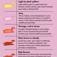 Newborn Baby Urine Colour Chart