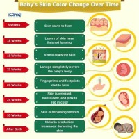 Newborn Skin Color Chart