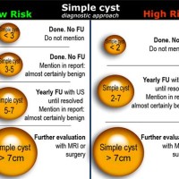 Ovarian Cyst Size Chart Uk