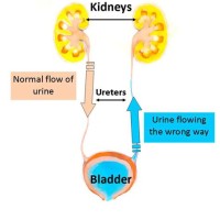 Process Of Urine Formation In The Kidneys Flow Chart