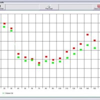 Real Time Line Chart Mschart