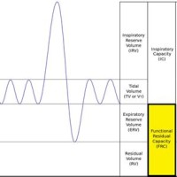 Residual Functional Capacity Chart