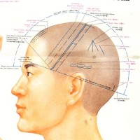 Scalp Acupuncture Points Chart