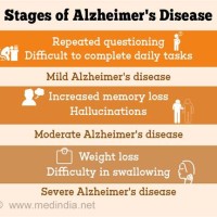 Ses Of Alzheimer 8217 S Disease Chart