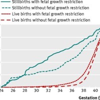 Stillbirth Rates By Week Chart