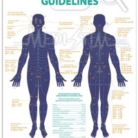 Tens Unit Electrode Placement Chart