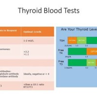 Thyroid Test Range Chart