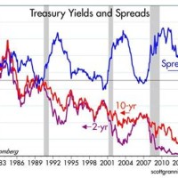 Treasury Bond Spread Chart