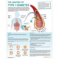 Type 1 Diabetes T Chart