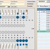 Types Of Charting In Dentistry