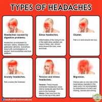 Types Of Headaches And Symptoms Chart