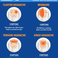 Types Of Headaches Location Chart