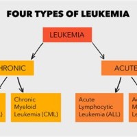 Types Of Leukemia Chart