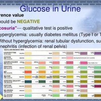 Urine Glucose Levels Chart