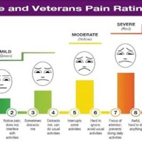 Va Rating Chart For Back Pain