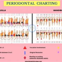 What Is A Dental Perio Charting