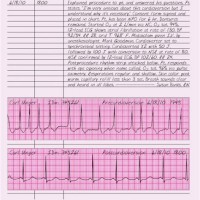 What Is Block Charting In Nursing