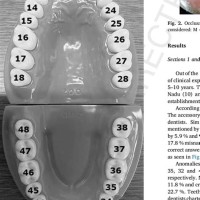 What Is Fdi Dental Charting